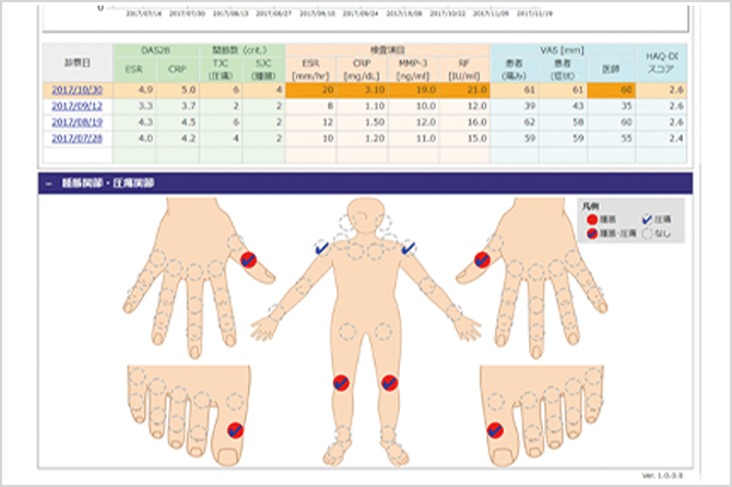 リウマチ診療支援システム電子カルテ